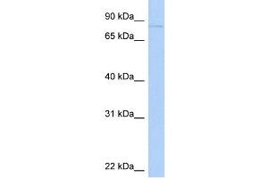 WB Suggested Anti-KIF2C Antibody Titration:  0.