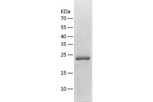 Western Blotting (WB) image for Glutathione S-Transferase mu 2 (Muscle) (GSTM2) (AA 1-218) protein (His-IF2DI Tag) (ABIN7123141)