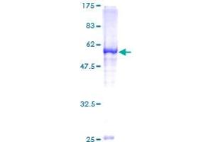 Image no. 1 for Multiple C2 Domains, Transmembrane 2 (MCTP2) (AA 1-306) protein (GST tag) (ABIN1310579) (MCTP2 Protein (AA 1-306) (GST tag))