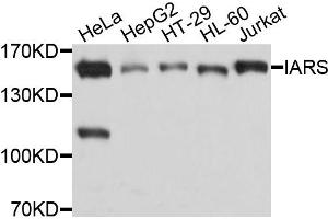 Western blot analysis of extracts of various cells, using IARS antibody. (IARS Antikörper)