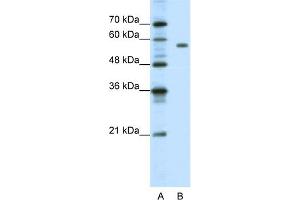 WB Suggested Anti-PBX2 Antibody Titration:  1.