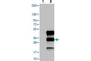 Western blot analysis of Lane 1: Negative control (vector only transfected HEK293T lysate). (C12orf43 Antikörper)