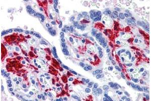Placenta, Human: Formalin-Fixed, Paraffin-Embedded (FFPE) (DDX58 Antikörper)