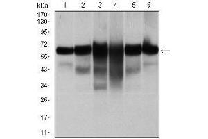 Western blot analysis using CK5 mouse mAb against A431 (1), MCF-7 (2), HeLa (3), HepG2 (4), 3T3-L1 (5), and COS-7 (6) cell lysate. (Cytokeratin 5 Antikörper)