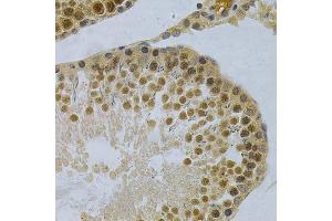 Immunohistochemistry (Paraffin-embedded Sections) (IHC (p)) image for anti-ELAV (Embryonic Lethal, Abnormal Vision, Drosophila)-Like 1 (Hu Antigen R) (ELAVL1) (AA 1-326) antibody (ABIN3022231)