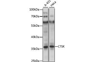 Western blot analysis of extracts of U-87MG cells, using CTSK antibody (ABIN6127669, ABIN6139234 and ABIN7101787) at 1:400 dilution. (Cathepsin K Antikörper  (AA 115-329))