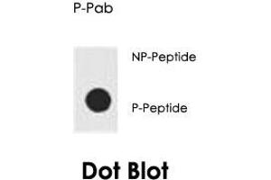 Dot blot analysis of AKT1 (phospho S129) polyclonal antibody  on nitrocellulose membrane. (AKT1 Antikörper  (pSer129))