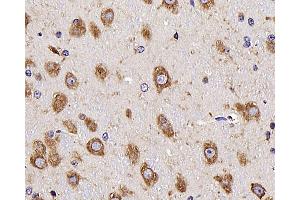 Immunohistochemistry analysis of parafffin-embedded mouse brain using NTS Polyclonal Antibody at dilution of 1:300. (Neurotensin Antikörper)