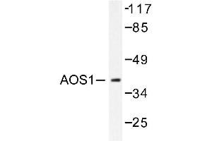 Image no. 1 for anti-SUMO1 Activating Enzyme Subunit 1 (SAE1) antibody (ABIN271943) (SAE1 Antikörper)