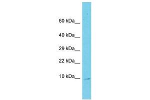 Host: Rabbit Target Name: C11orf75 Sample Type: Fetal Liver lysates Antibody Dilution: 1. (SMCO4 Antikörper  (N-Term))
