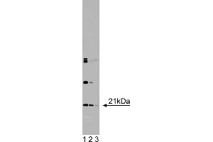 Western Blotting (WB) image for anti-Dihydrofolate Reductase (DHFR) (AA 1-186) antibody (ABIN968119)