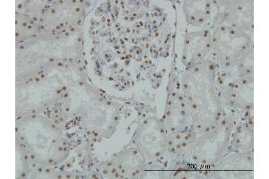 Immunostaining (ISt) image for anti-Lysine (K)-Specific Demethylase 1A (KDM1A) (AA 753-851) antibody (ABIN564989)