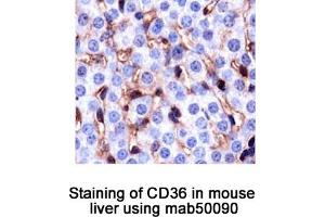 Image no. 1 for anti-CD36 (CD36) antibody (ABIN363244)