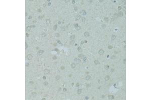 Immunohistochemistry of paraffin-embedded rat brain using MBD2 antibody (ABIN5971247) at dilution of 1/100 (40x lens).