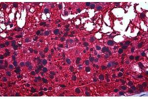 Human Testis: Formalin-Fixed, Paraffin-Embedded (FFPE) (CAPZB Antikörper  (AA 192-272))