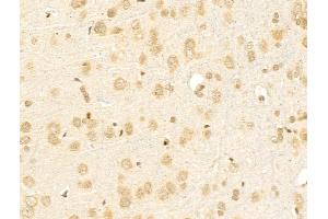 ABIN6256948 and ABIN6275299 at 1/100 staining Rat brain tissue by IHC-P. (NBPF1,9,10,12,14,15,16,20 (C-Term) Antikörper)