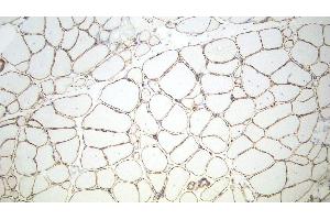 Immunohistochemistry (IHC) image for anti-Utrophin (UTRN) antibody (ABIN7538877) (Utrophin Antikörper)