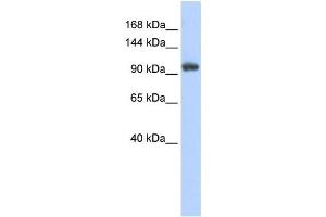 Western Blotting (WB) image for anti-Ring Finger Protein 31 (RNF31) antibody (ABIN2458723) (RNF31 Antikörper)