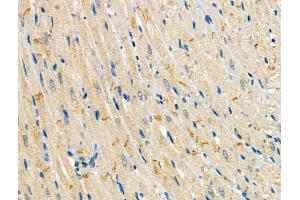 Phospho-Mitofusin 2 (Ser442) Antibody at 1/100 staining Rat heart tissue by IHC-P.