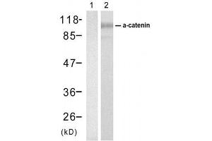 Western blot analysis of extracts from SW626 cell usingα-catenin (Ab-177) Antibody (E021521).