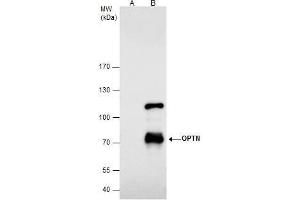 IP Image Optineurin antibody immunoprecipitates Optineurin protein in IP experiments. (OPTN Antikörper)