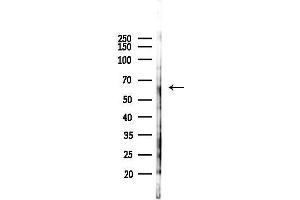 anti-Zinc Finger Protein 461 (ZNF461) antibody