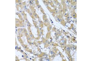 Immunohistochemistry of paraffin-embedded human gastric using STX7 antibody at dilution of 1:100 (x40 lens). (Syntaxin 7 Antikörper)