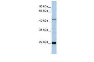 Image no. 1 for anti-Zinc Finger Protein 581 (ZNF581) (AA 72-121) antibody (ABIN6737781) (ZNF581 Antikörper  (AA 72-121))