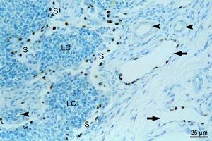 Immunohistochemical detection of endogenous PROX1 (paraffin sections) in equine mandibular lymph nodeusing anti-PROX1, pAb (dilution 1:200) , counterstained with toluidine blue. (PROX1 Antikörper  (AA 547-737))