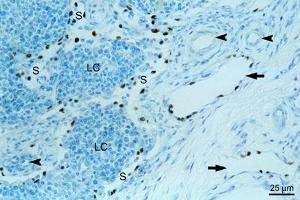Immunohistochemical detection of endogenous PROX1 (paraffin sections) in equine mandibular lymph nodeusing anti-PROX1, pAb (dilution 1:200) , counterstained with toluidine blue.