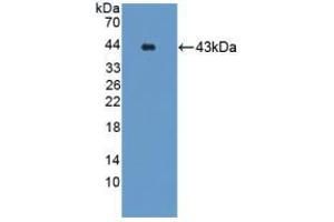 Western blot analysis of recombinant Mouse GRPR. (GRPR Antikörper  (AA 1-116))