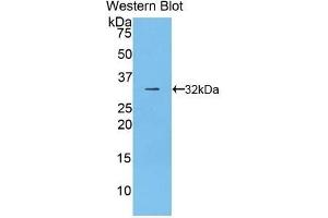 Detection of Recombinant CD2AP, Rat using Polyclonal Antibody to CD2 Associated Protein (CD2AP) (CD2AP Antikörper  (AA 368-623))