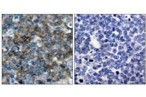 Immunohistochemical analysis of paraffin-embedded human tonsil carcinoma tissue using VASP (phospho-Ser157) antibody (E011214). (VASP Antikörper  (pSer157))