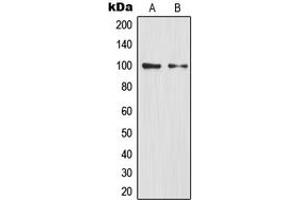 Western blot analysis of NF-kappaB p100 expression in HEK293T (A), mouse liver (B) whole cell lysates. (NFKB2 Antikörper  (C-Term))