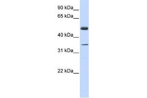 WB Suggested Anti-ZNF223 Antibody Titration:  0. (ZNF223 Antikörper  (Middle Region))
