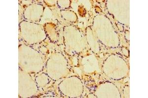 Immunohistochemistry of paraffin-embedded human thyroid tissue using ABIN7154596 at dilution of 1:100 (RIT1 Antikörper  (AA 1-219))