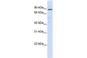 ATP6V0A2 antibody used at 1 ug/ml to detect target protein. (ATP6V0A2 Antikörper  (N-Term))