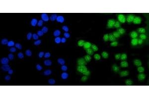 anti-Androgen Receptor (AR) (AA 629-920) antibody