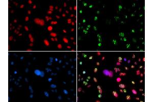 Immunofluorescence analysis of GFP-RNF168 transgenic U2OS cells using RAG2 antibody (ABIN5973278). (RAG2 Antikörper)