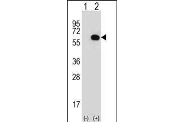 Glycerol Kinase Antikörper  (N-Term)