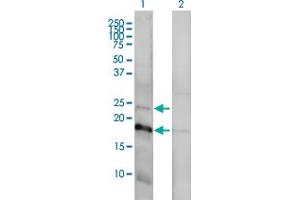 Western Blot analysis of CLDN1 expression in transfected 293T cell line by CLDN1 monoclonal antibody (M01), clone 1C5-D9. (Claudin 1 Antikörper  (AA 1-211))