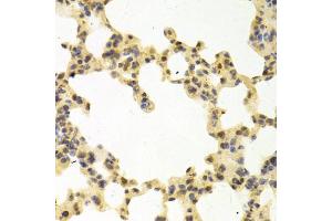 Immunohistochemistry of paraffin-embedded mouse lung using RANGAP1 antibody (ABIN5973116) at dilution of 1/100 (40x lens). (RANGAP1 Antikörper)