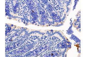 ABIN7094537 and ABIN7098586 at 1/100 staining Rat colorectal tissue by IHC-P. (FGF7 Antikörper  (Internal Region))