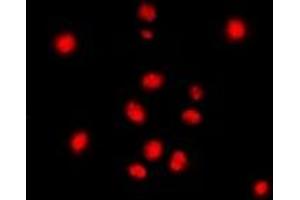 Immunofluorescent analysis of STAG3 staining in Jurkat cells. (STAG3 Antikörper  (C-Term))
