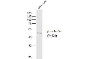 Rat cerebrum lysates probed with Src (Tyr529) Polyclonal Antibody, Unconjugated  at 1:500 dilution and 4˚C overnight incubation. (Src Antikörper  (pTyr529))