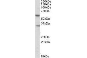Western Blotting (WB) image for anti-Sialic Acid Binding Ig-Like Lectin 6 (SIGLEC6) (Internal Region) antibody (ABIN2464895) (SIGLEC6 Antikörper  (Internal Region))