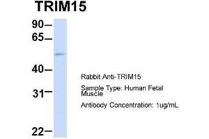Host: Rabbit  Target Name: TRIM15  Sample Tissue: Human Fetal Muscle  Antibody Dilution: 1. (TRIM15 Antikörper  (Middle Region))