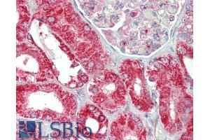 ABIN571117 (5µg/ml) staining of paraffin embedded Human Kidney. (CHCHD3 Antikörper  (AA 151-164))
