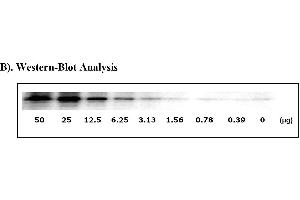 Image no. 6 for Signal Transducer and Activator of Transcription 3 (Acute-Phase Response Factor) (STAT3) ELISA Kit (ABIN625245) (STAT3 ELISA Kit)