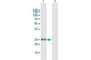 Western Blot analysis of OIP5 expression in transfected 293T cell line by OIP5 MaxPab polyclonal antibody.
